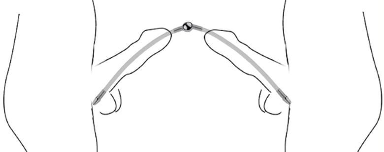 Harnröhrenplug Duo 24 x 0,8 cm