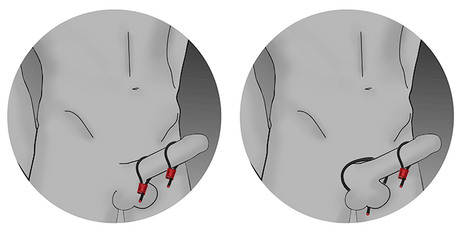Penisring Prestige ElectraLoops Silber